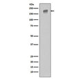 Western blot testing of human HeLa cell lysate with EGFR antibody. Expected molecular weight: 134-170 kDa depending on glycosylation level.
