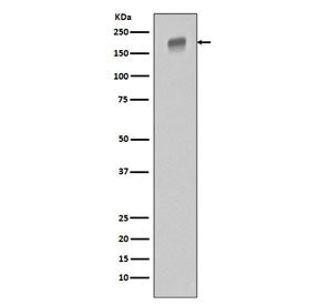 Western blot testing of human HeLa cell lysate with EGFR antibody. Expected molecular weight: 134-170 kDa depending on glycosylation level.