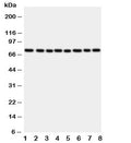 Western blot testing of CYPOR antibody and rat samples: 1. ovary; 2. lung; 3. testis; 4. spleen; and human samples 5. A549; 6. HeLa; 7. SKOV; 8. MCF-7 cell lysate. Predicted/observed molecular weight: ~77 kDa.