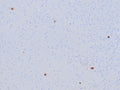 IHC staining of FFPE human HSV-infected tissue with Herpes Simplex Virus Type I antibody (clone HSVI/8375R). HIER: boil tissue sections in pH 9 10mM Tris with 1mM EDTA for 20 min and allow to cool before testing.