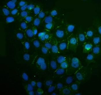 Immunofluorescent staining of human A431 cells with IQGAP1 antibody (green) and DAPI nuclear stain (blue). HIER: boil tissue sections in pH6, 10mM citrate buffer, for 20 min and allow to cool before testing.