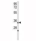 Western blot analysis of IGFBP2 antibody and human Jurkat cell lysate. Predicted/observed molecular weight ~35 kDa.