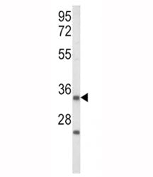 Western blot analysis of IGFBP2 antibody and human Jurkat cell lysate. Predicted/observed molecular weight ~35 kDa.