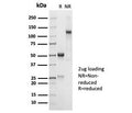 SDS-PAGE analysis of purified, BSA-free recombinant CD45RA antibody (clone PTPRC/7018R) as confirmation of integrity and purity.