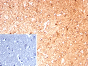 IHC staining of FFPE human brain tissue with GLUL antibody (clone GLUL/8889R). Inset: PBS used in place of primary Ab (secondary Ab negative control). HIER: boil tissue sections in pH 9 10mM Tris with 1mM EDTA for 20 min and allow to cool before testing.