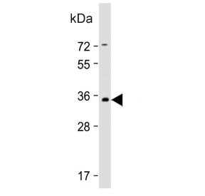 Western blot testing of human brain tissue lysate with PRRT2 antibody. Predicted molecular weight ~35 kDa.