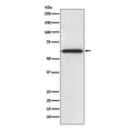 Western blot testing of human HepG2 cell lysate with Catalase antibody. Predicted molecular weight ~60 kDa.