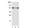Western blot testing of 1) human brain, 2) mouse brain and 3) rat brain tissue lysate with Activin receptor type-1B antibody. Predicted molecular weight ~57 kDa.