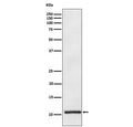 Western blot testing of human plasma lysate with APOA2 antibody. Predicted molecular weight ~11 kDa.