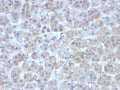 IHC staining of FFPE human adrenal gland tissue with Interleukin-1 beta antibody (clone IL1B/463). HIER: boil tissue sections in pH 9 10mM Tris with 1mM EDTA for 20 min and allow to cool before testing.