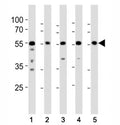 Western blot analysis of lysate from (1) A431, (2) RD, (3) mouse NIH3T3, (4) mouse C2C12, and (5) rat PC-12 cell line using Src antibody at 1:1000.