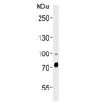 Western blot testing of human heart tissue lysate with ZNF219 antibody. Predicted molecular weight ~77 kDa.