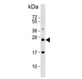 Western blot testing of human HCT-116 cell lysate with RAB8A antibody. Predicted molecular weight ~24 kDa.