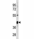 Txnip antibody western blot analysis in mouse stomach tissue lysate.