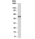 Western blot testing of rat spinal cord lysate with TNFR2 antibody at 0.2ug/ml. Predicted molecular weight: 50/70~80kDa (unmodified/glycosylated).