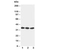 Western blot testing of DKK1 antibody and Lane 1: U87; 2: MCF-7; 3: A549 cell lysate. Predicted molecular weight: 26-40 kDa depending on glycosylation level.