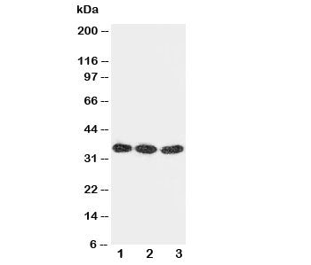 Western blot testing of DKK1 antibody and Lane 1: U87; 2: MCF-7; 3: A549 cell lysate. Predicted molecular weight: 26-40 kDa depending on glycosylation level.