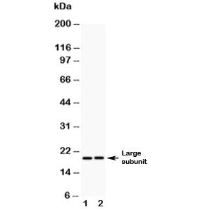 Western blot testing of Caspase-8 antibody (0.5ug/ml) and Lane 1: human A549; 2: (h) HeLa lysate. Predicted molecular weight: ~55 kDa (pro), ~40 kDa (large + small subunit), ~20 kDa (large subunit).