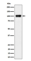 Western blot analysis of Nesprin 3 expression in human 293 cell lysate using SYNE3 antibody. A single band is detected at ~100 kDa, running slightly below the ~112 kDa prediction. The migration is consistent with the reported nesprin-3 isoform pattern (long form ~108-112 kDa, short form ~95-105 kDa) and the faster apparent mobility of coiled-coil nesprins on SDS-PAGE.