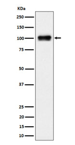 Western blot analysis of Nesprin 3 expression in human 293 cell lysate using SYNE3 antibody. A single band is detected at ~100 kDa, running slightly below the ~112 kDa prediction. The migration is consistent with the reported nesprin-3 isoform pattern (long form ~108-112 kDa, short form ~95-105 kDa) and the faster apparent mobility of coiled-coil nesprins on SDS-PAGE.