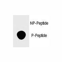 Dot blot analysis of phospho-FOXP3 antibody. 50ng of phos-peptide or nonphos-peptide per dot were spotted.