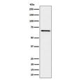 Western blot testing of human Ramos cell lysate with GRK6 antibody. Predicted molecular weight ~66 kDa.
