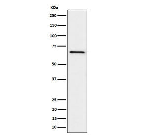 Western blot testing of human Ramos cell lysate with GRK6 antibody. Predicted molecular weight ~66 kDa.