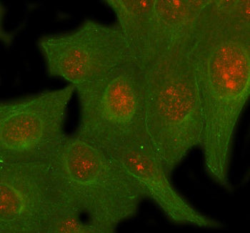 Immunofluorescent staining of SIRT6 using anti-SIRT6 antibody (red) and anti-Beta Tubulin antibody (green). SIRT6 was detected in immunocytochemical section of U2OS cell. Enzyme antigen retrieval was performed using IHC enzyme antigen retrieval reagent for 15 mins. The cells were blocked with 10% goat serum. And then incubated with 5 ug/ml rabbit anti-SIRT6 antibody and mouse anti-Beta Tubulin antibody overnight at 4oC.