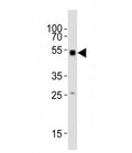 Western blot testing of Smad1 antibody at 1:1000 dilution + mouse skeletal muscle lysate; Predicted molecular weight: 52~60 kDa.