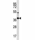 NKX2.2 antibody western blot analysis in 293 lysate.