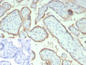 IHC staining of FFPE human placental tissue with HCG-alpha antibody (clone hCGa/7873). Inset: PBS used in place of primary Ab (secondary Ab negative control). HIER: boil tissue sections in pH 9 10mM Tris with 1mM EDTA for 20 min and allow to cool before testing.