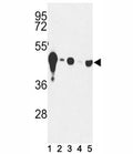 Western blot analysis of NSE antibody and (1) mouse cerebellum tissue and (2) Y79, (3) HepG2, (4) Jurkat and (5) CEM lysate. Predicted molecular weight: ~47 kDa.