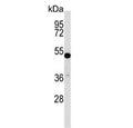 Western blot testing of mouse stomach tissue lysate with TFCP2L1 antibody. Predicted molecular weight ~55 kDa.