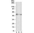 Western blot testing of human lymph node (A), spleen (B) and placenta (C) lysates with IDO antibody at 0.5ug/ml. Predicted molecular weight ~46 kDa.