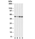 Western blot testing of human [A], fetal mouse [B], adult mouse [C] and adult rat [D] heart lysates with ATP5A1 antibody at 0.01ug/ml. Predicted molecular weight ~54-60 kDa (multiple isoforms).