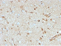 IHC staining of FFPE human brain tissue with S100B antibody (clone S100B/4153) at 2ug/ml. HIER: boil tissue sections in pH 9 10mM Tris with 1mM EDTA for 20 min and allow to cool before testing.