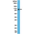 Western blot testing of human LNCaP cell lysate with recombinant CD276 antibody at 1:10,000 dilution. Expected molecular weight: 57-110 kDa depending on level of glycosylation.