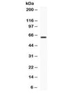 Western blot testing of human COLO320 cell lysate with TCF7L1 antibody. Expected/observed molecular weight ~63 kDa.