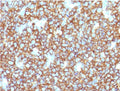 IHC testing of recombinant CD20 antibody and FFPE human tonsil tissue. HIER: steam section in pH 9 10mM Tris with 1mM EDTA for 20 min.
