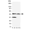Western blot testing of Haptoglobin antibody and Lane 1: Raji; 2: HL-60; 3: HUT102; 4: Jurkat; 5: CEM cell lysate. Predicted molecular weight: 35-40 kDa (beta chain), 45-50 kDa (alpha + beta chain).