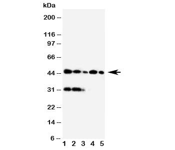 Western blot testing of Haptoglobin antibody and Lane 1: Raji; 2: HL-60; 3: HUT102; 4: Jurkat; 5: CEM cell lysate. Predicted molecular weight: 35-40 kDa (beta chain), 45-50 kDa (alpha + beta chain).