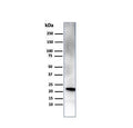 Western blot testing of human pancreas tissue with RBP4 antibody. Predicted molecular weight ~23 kDa.