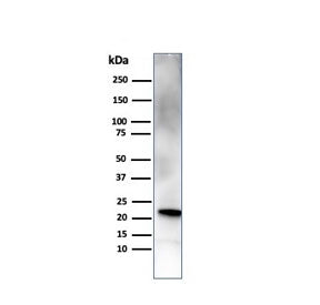 Western blot testing of human pancreas tissue with RBP4 antibody. Predicted molecular weight ~23 kDa.