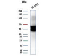 Western blot testing of human SK-BR-3 cell lysate with Cytokeratin-7 antibody (clone KRT7/3733).