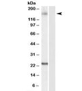 Western blot testing of HeLa lysate with GOLGA3 antibody at 0.1ug/ml. Predicted/observed molecular weight 160~170kDa.