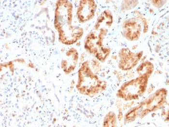 IHC staining of FFPE human kidney with RBP4 antibody. HIER: boil tissue sections in pH 9 10mM Tris with 1mM EDTA for 20 min and allow to cool before testing.