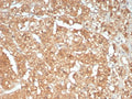 IHC staining of FFPE human adrenal gland tissue with ATM antibody (clone ATM/9472). Inset: PBS used in place of primary Ab (secondary Ab negative control). HIER: boil tissue sections in pH 9 10mM Tris with 1mM EDTA for 20 min and allow to cool before testing.