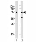 Western blot testing of Smad3 antibody at 1:1000 dilution. Lane 1: mouse brain tissue lysate; 2: rat brain tissue lysate; Observed molecular weight: 48~55 kDa.