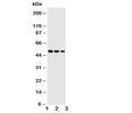 Western blot testing of Kallistatin antibody and Lane 1: SMMC-7721; 2: COLO320; 3: Jurkat cell lysate