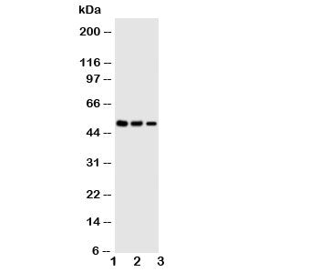 Western blot testing of Kallistatin antibody and Lane 1: SMMC-7721; 2: COLO320; 3: Jurkat cell lysate